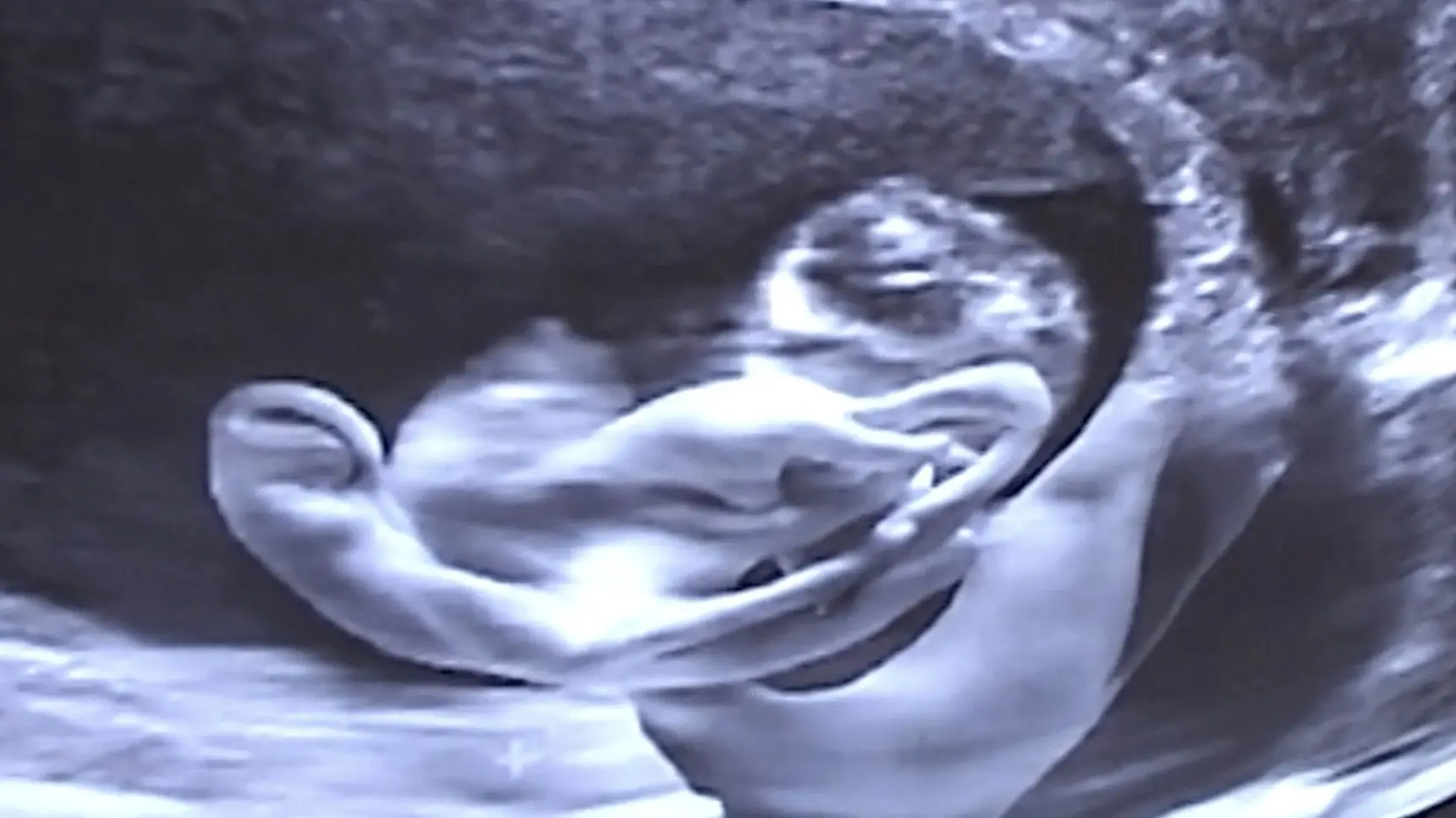 Castration Movie Anthology iii. Year of the Hyaena backdrop