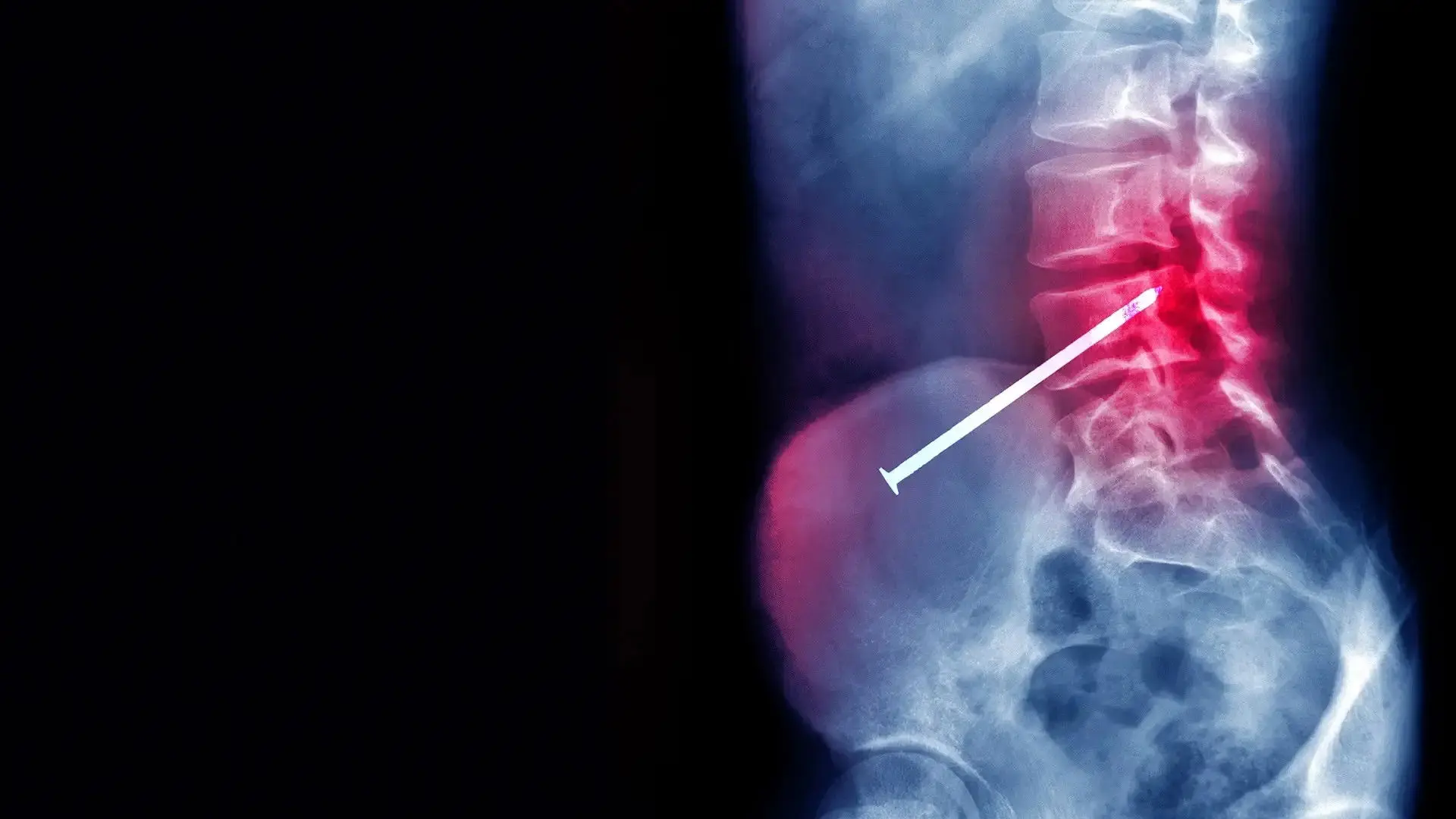 Body Invaders backdrop