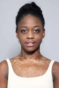 Michaela DePrince